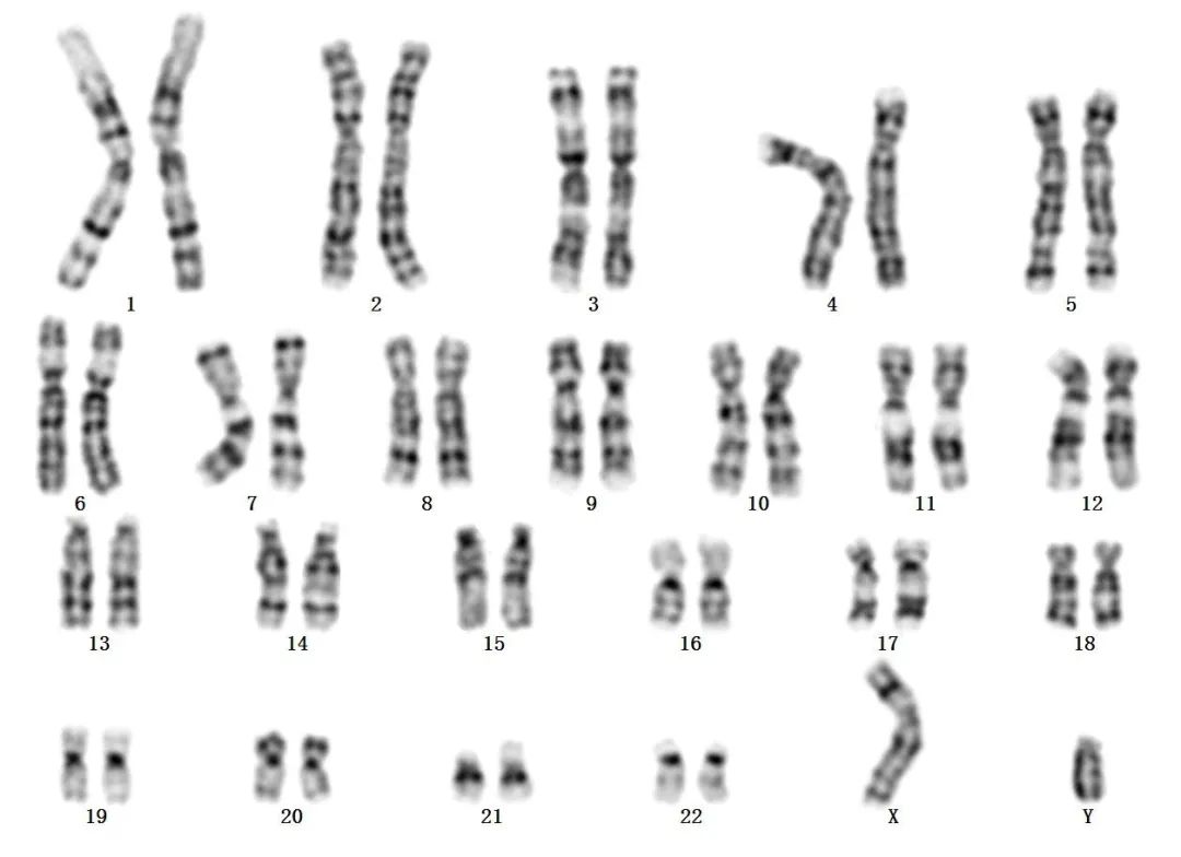 了解染色体和染色体核型检测- 01